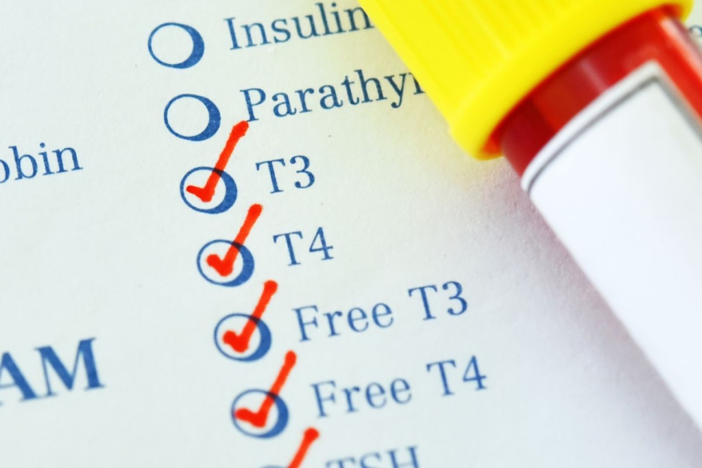 proveravajte nivo hormona štitne žlezde