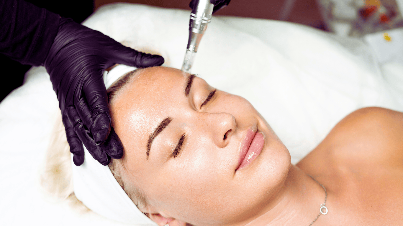 Microneedling
