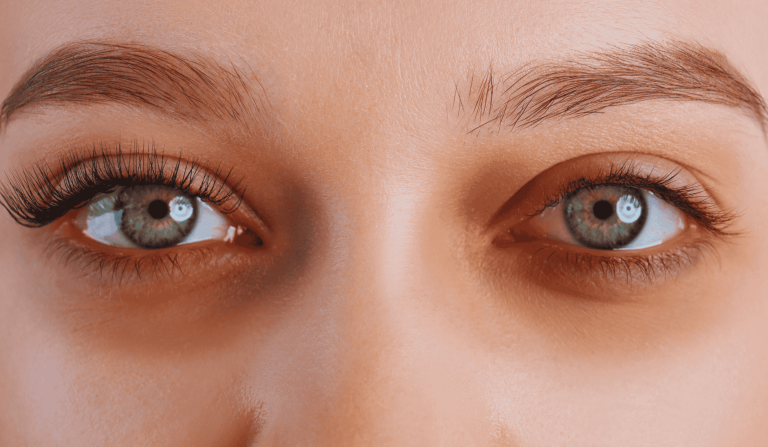 prirodni načini za uklanjanje podočnjaka