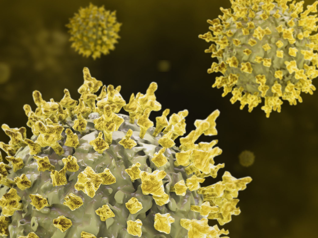 Epstein-Barr virus bolesti